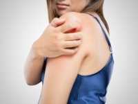 体のパーツ別！　「ニキビ」ができる原因と対処法