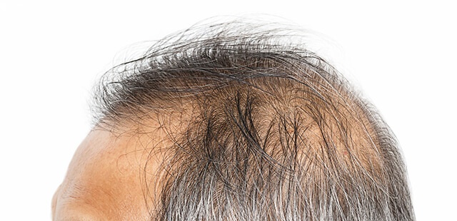 「Doctors Me（ドクターズミー）」コラム画像