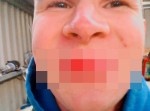 【閲覧注意】“凍ったパイプ”を舐めてしまった少年の末路…