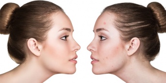 「Doctors Me（ドクターズミー）」コラム画像