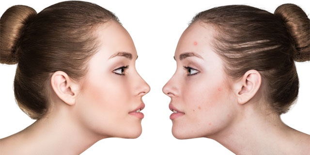 「Doctors Me（ドクターズミー）」コラム画像