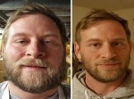 お酒をやめて人生が変わった人のビフォーアフター１０選！