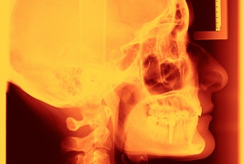 記憶力を15％強化する新しいタイプの脳に埋め込むインプラントが開発される（米研究）