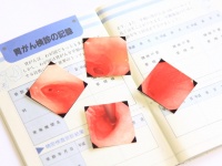 渡辺謙が、胃がんの手術を公表！・・・早期発見で胃がんを手術した芸能人・4選