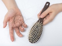 髪が抜けて円形脱毛症に!?　ストレスによって起こった「体の変化」4選