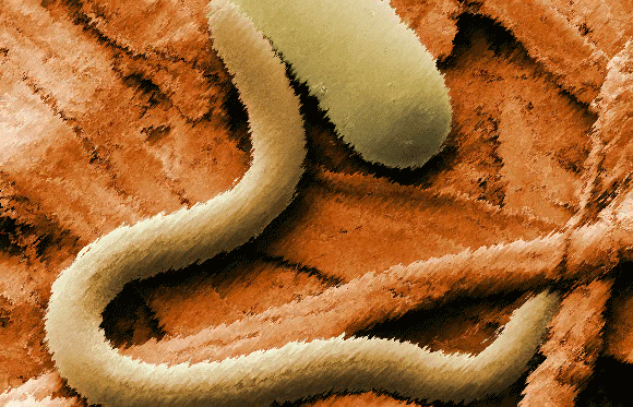 4万2000年の眠りから覚め、永久凍土に閉じ込められていたワームが生き返る（ロシア・シベリア）※線虫注意