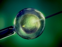 がん治療を受けても卵子凍結などの方法で子どもを授かることが可能に（depositphotos.com）