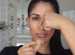 【朗報】ニキビが一晩で消える画期的な裏技が発見される！