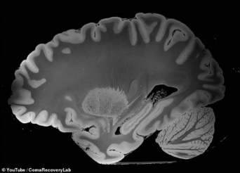 これまでで最も精細な人間の脳のスキャン映像。MRIで100時間かけて撮影