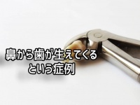 本当にあった奇妙な症例。鼻の中で歯が成長