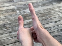 普通の人の2倍！？12センチの長～い親指を持つ男性が話題に（アメリカ）