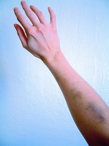 Raise your hand if you want to volunteer