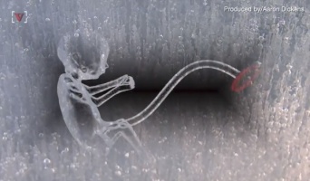 米国人女性が24年以上凍結保存されていた受精卵で女児を出産