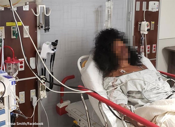 ゾンビメイクのまま発作を起こした女性。あまりのクオリティに病院側は傷を負っていると勘違い（アメリカ）※ゾンビ注意