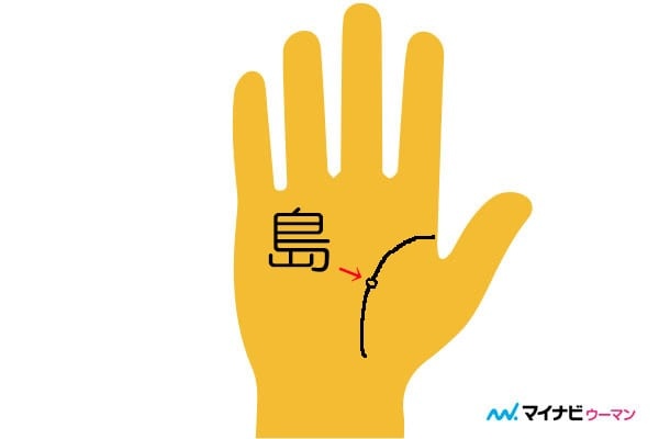 凶相！　手のひらの「島」の見方【手相占い】