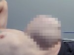 【グロ注意】腹部の“巨大ヘルニア”が膨らむ瞬間…