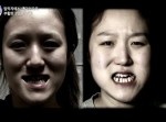 双子姉妹がセットで整形→　お互い同じ顔の美女に変身！