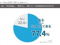 株式会社サイプラスのプレスリリース画像