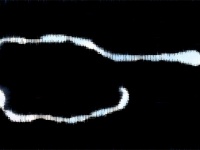 男性の脳から体長10センチの生きた条虫が発見される。十分に加熱されていない食べ物が原因（中国）※条虫注意