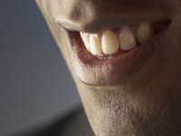 いくら好きでもムリっ！　キスしたくない「男性の唇」・5選