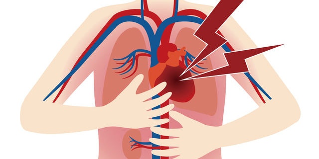 大動脈が裂ける