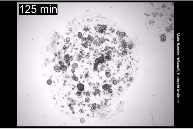 感情により涙が作られる様子
