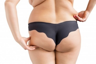 やだ正月太り!?　女子が自覚するのはどこにお肉がついたとき？