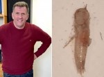 【グロ注意】痰だと思ったら…なぜか幼虫が吐き出される！？