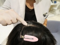 将来、薄毛になるかは●●で決まる！？　つやつやで太い髪をつくるにはどうすればいい？