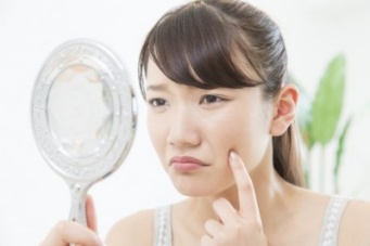 早く消えて～！　ニキビを治す方法4選
