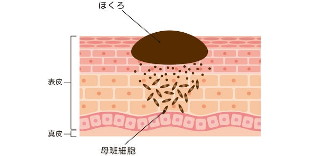 ほくろの仕組み
