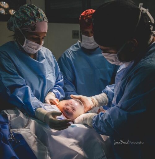 羊膜に包まれたまま生まれた赤ちゃん