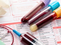 血液検査だけで8種類の「がん」を発見できる新たな検査法とは？（depositphotos.com）