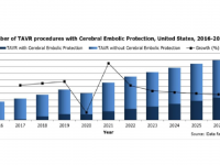 株式会社グローバルインフォメーションのプレスリリース画像