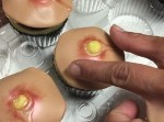 【閲覧注意】ニキビ型カップケーキが登場！ これで思う存分潰せるぞ！