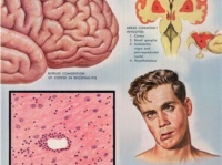 手描きなのに驚くほど精巧。医療画家が描いた病理学イラスト（医療画注意）