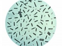 顕微鏡で見たボツリヌス菌　画像は「Wikipedia」より引用