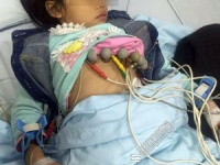 病院で心電図を取る被害園児