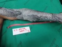 半魚人みたいになるけど本当に効果がある。淡水魚「ティラピア」の皮を使った火傷の治療法