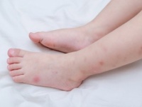 オゲェェェ、汚っ！　男性がマジで萎えた「女性の生足」4つ