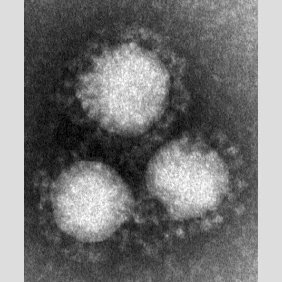 コロナ後遺症で「ED」に!? 若者でも無症状でも発症の恐れ