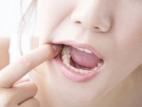 おえっ、きたねぇ！　男性がドン引きした女性の歯の特徴4つ