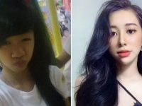 恋人とつらい別れをした女性、19歳で美容整形手術を受け現在の姿をシェア。後悔はしていない（ベトナム）
