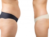 結局、胸!?　「ガリガリ」VS「おデブ」、男性ウケがよさそうなのは？
