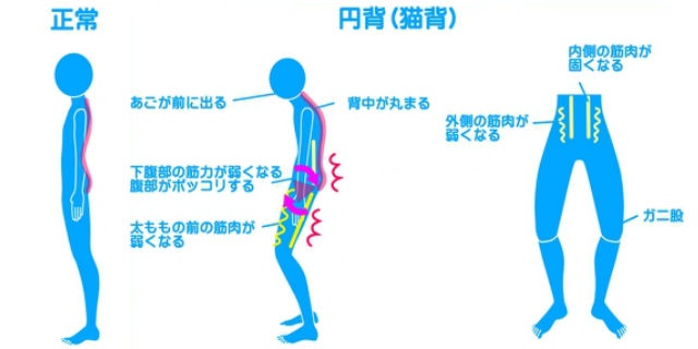 猫背の人の特徴