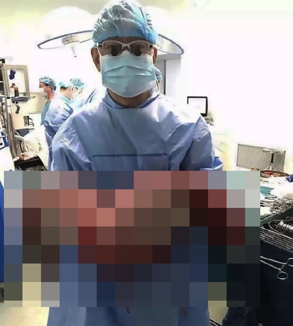 13キロの大腸を除去
