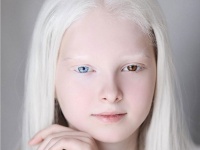 オッドアイとアルビノ、2つのスペシャルを持って生まれたチェチェンの美しい少女（ロシア）