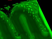 3Dプリンターで人工胎盤が作り出される。本物の胎盤と同じように機能（オーストリア研究）