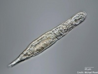 ゾンビ復活のよう。永久凍土で冬眠していた輪形動物が2万4000年の時を経て蘇り増殖する