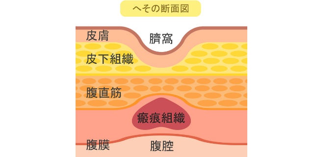 へその構造